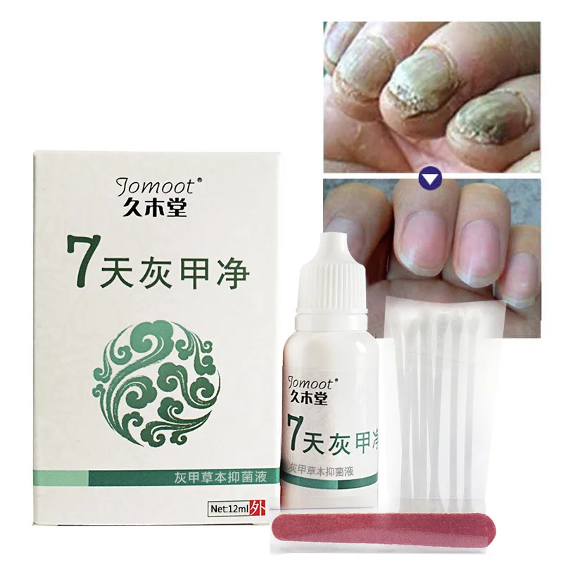Deget de la picior Deget de Tratament Ciuperca Unghiilor Anti Fungice Infecție cu Tampoane de Bumbac J9 Imagine 4